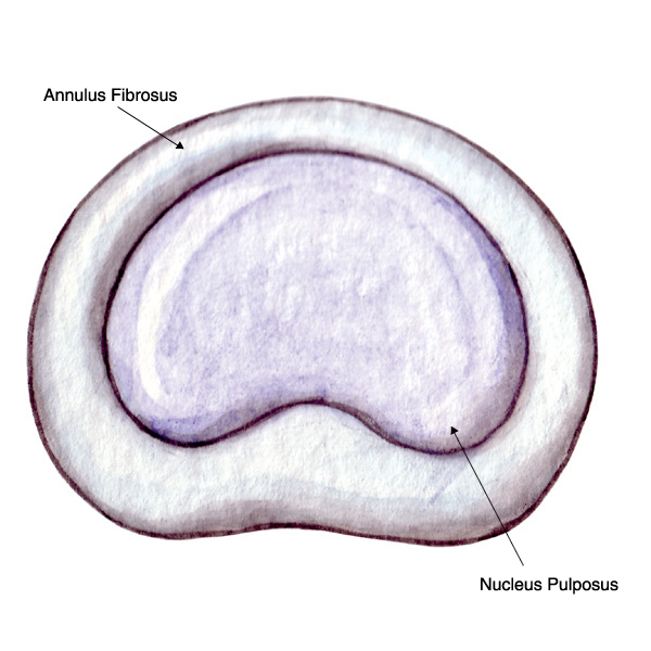 Axial View of Disc